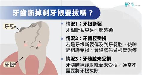 牙齒掉了|牙齒斷掉一定要拔掉嗎？牙根還在可以不拔嗎？